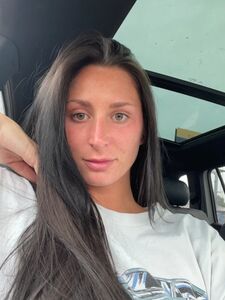 splatxo onlyfans leaks nude photos and videos