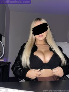 WettMelons Hot Onlyfans leaks - Most Bought Albums